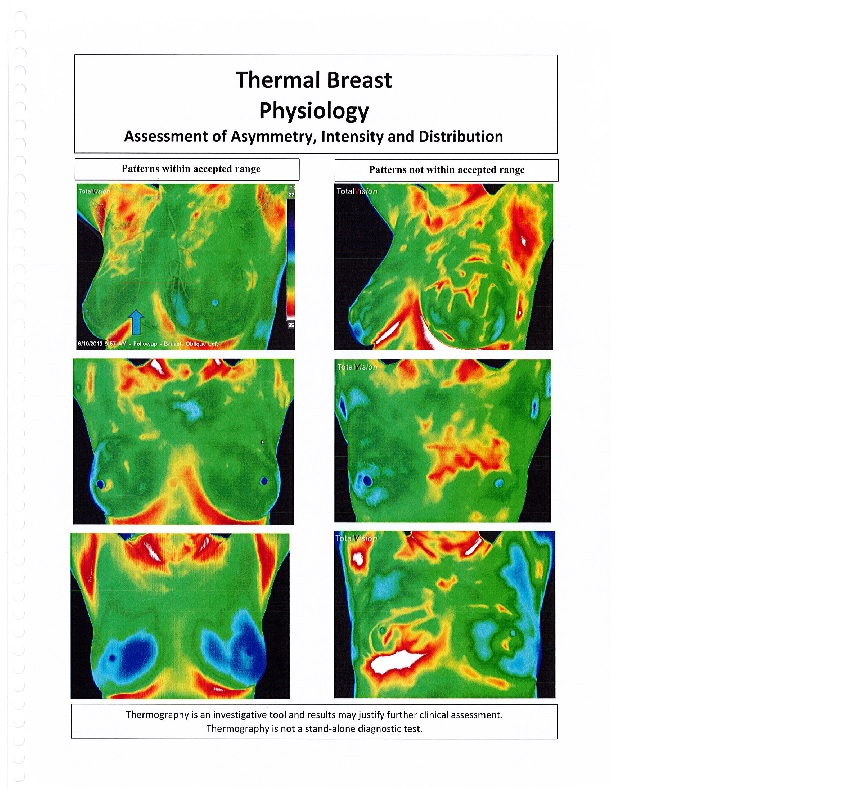 Thermography -- Thermal Breast Physiology